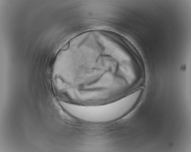 X0000112731001200910011152