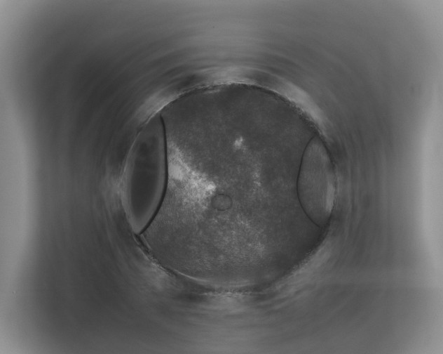 X0000112750785200908201417