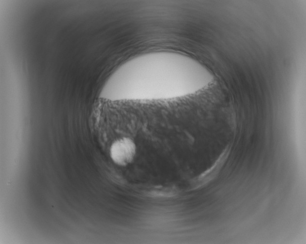 X0000112760175200908201041