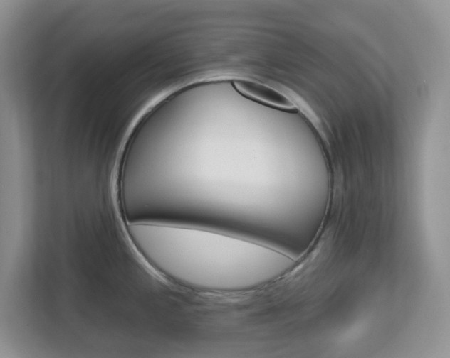 X0000112761197200908201027