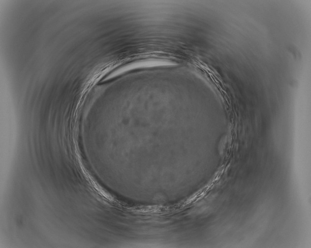 X0000112770049200908201516