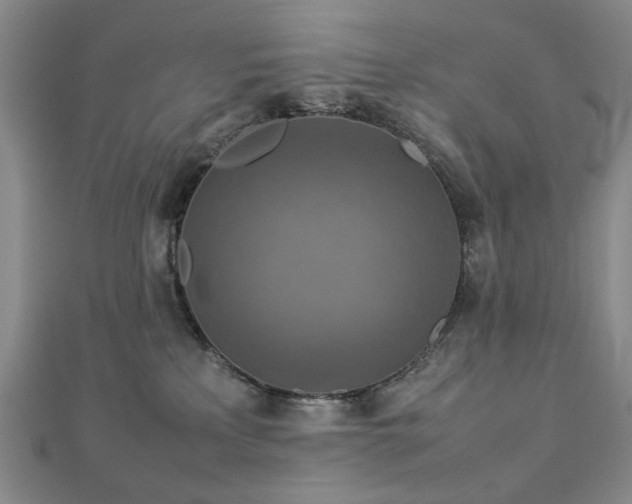 X0000112770233200908201514