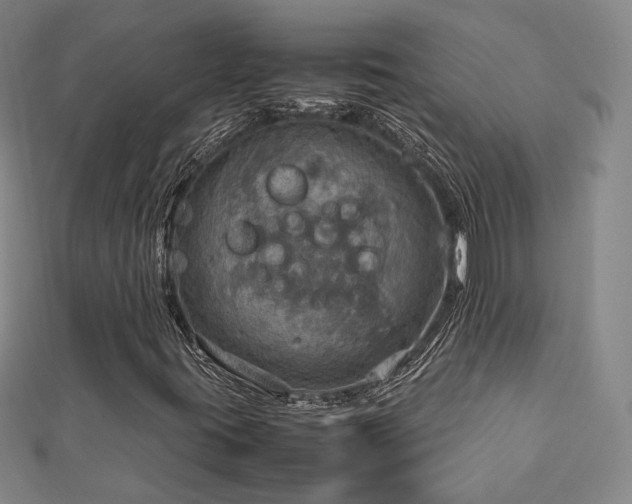 X0000112771395200908201457