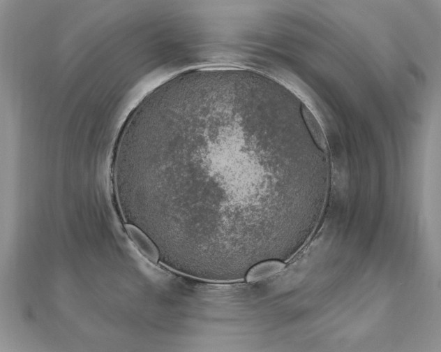 X0000112781485200908271652