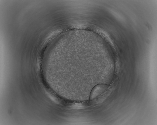 X0000112800114200910021128