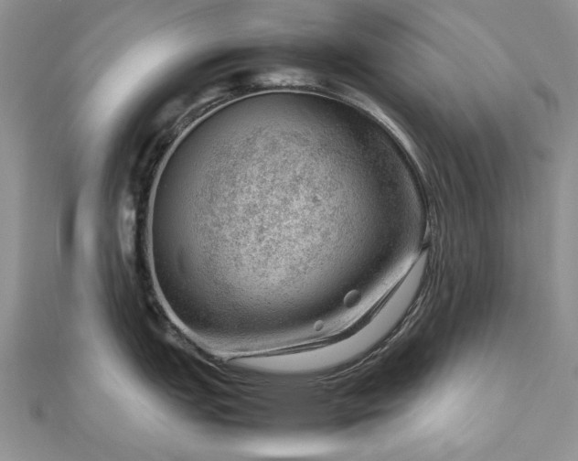 X0000112811151200909041449