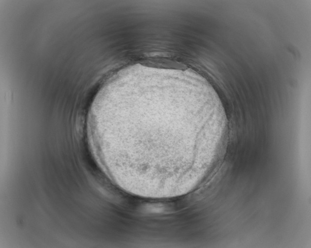 X0000112810171200910021148