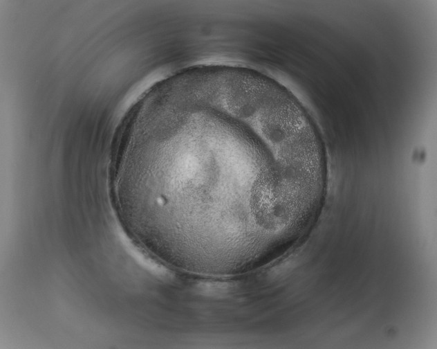 X0000112851237200909041522