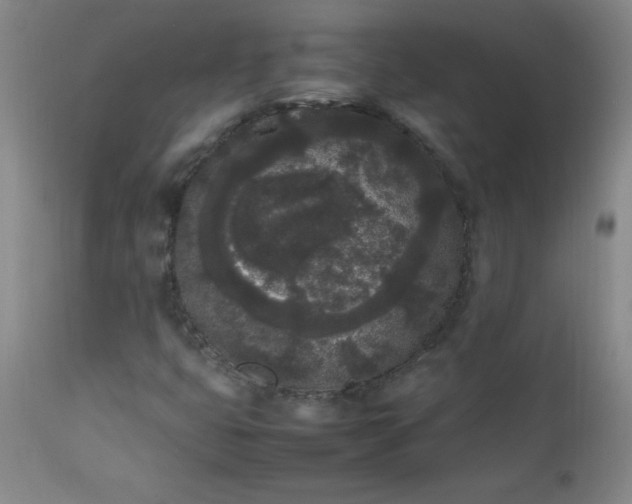 X0000112851399200909041518