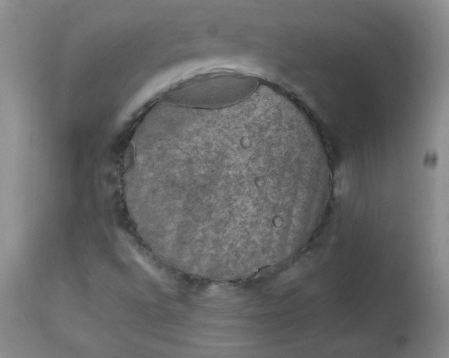 X0000112851496200909041517