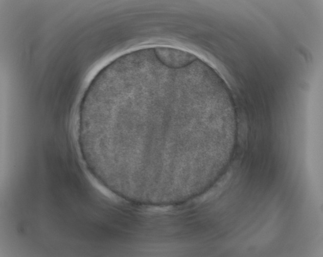 X0000112851519200910021241