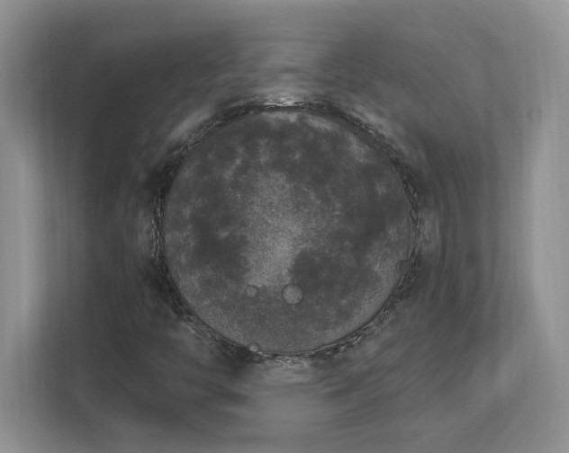 X0000112861446200908211311