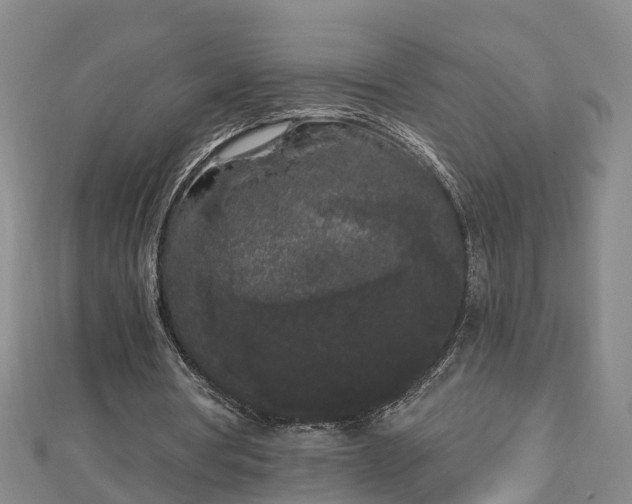 X0000112860386200908281608