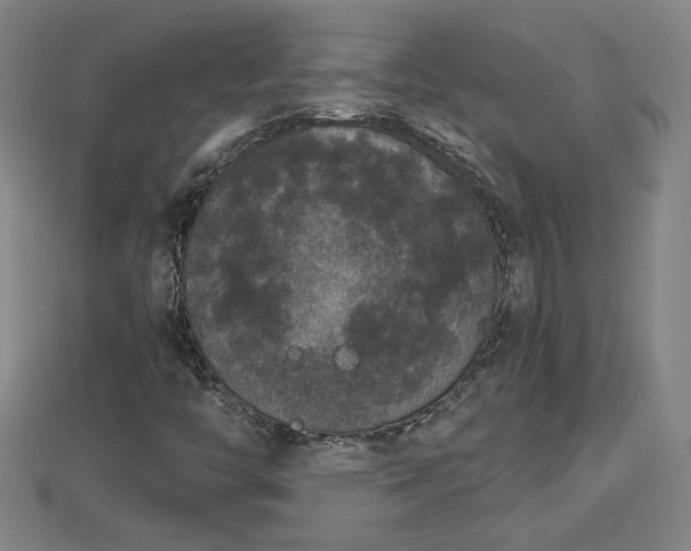 X0000112861446200908281553