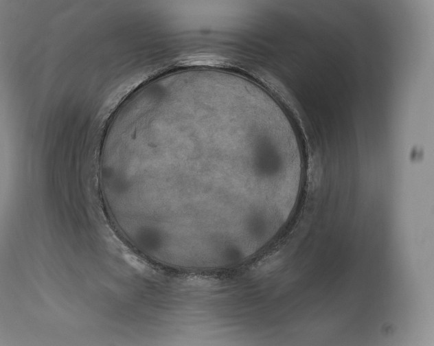 X0000112860529200909041555