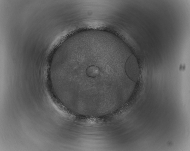 X0000112860736200909041553