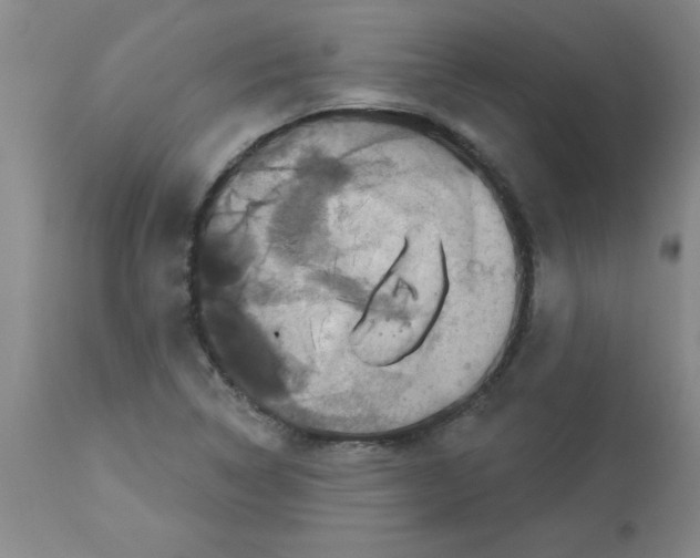 X0000112861314200909181751