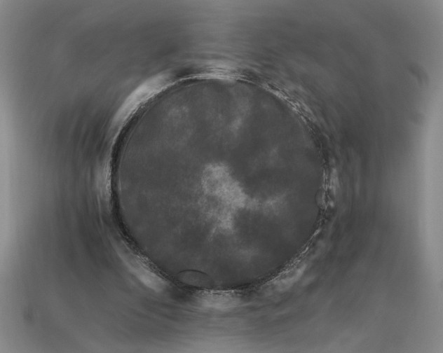 X0000112900296200909111531
