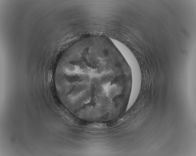 X0000112900711200909111525