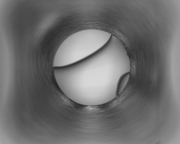 X0000112940477200908241010