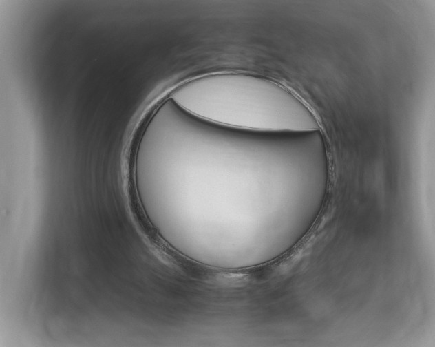 X0000112950055200908241035
