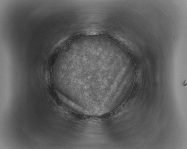 X0000112951446200908311500