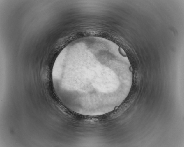 X0000112950760200909211154