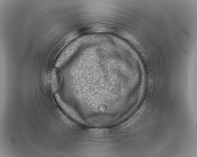 X0000112951185200909211148