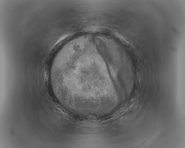 X0000112951206200909211147