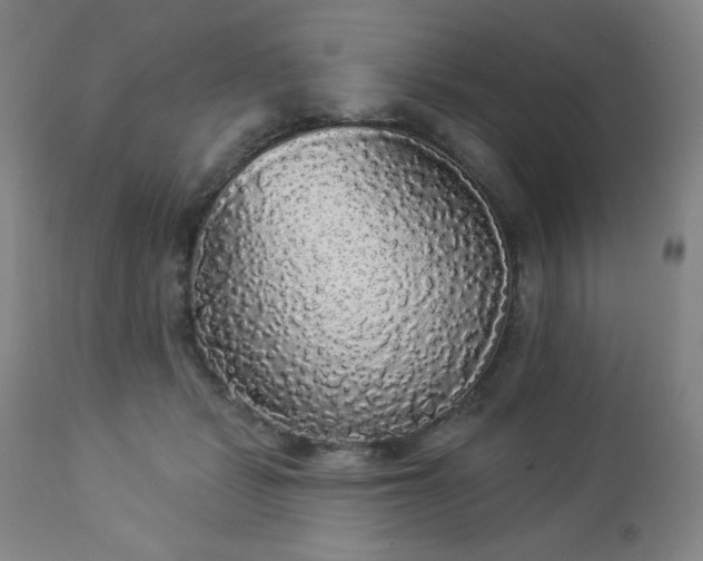 X0000112960461200909031025