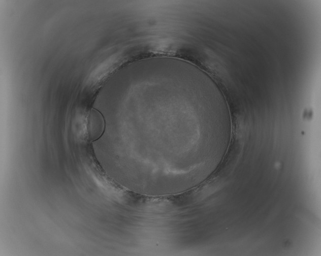 X0000112961154200909031015