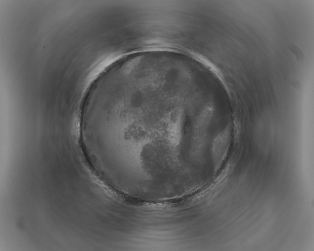 X0000112961415200909101623