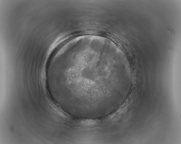 X0000112960198200909171304