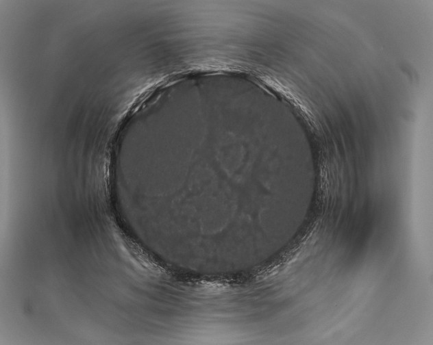 X0000113010592200908271411