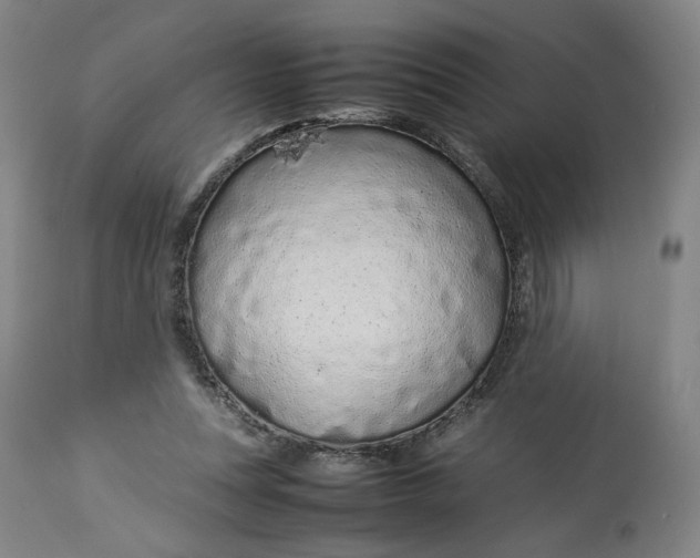 X0000113010351200909171435