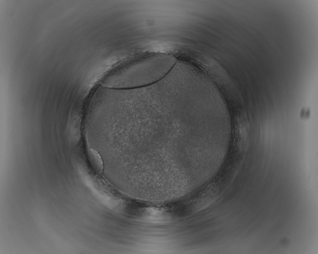 X0000113020496200909171457