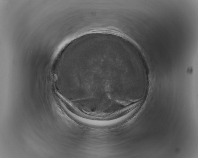 X0000113021506200909171441