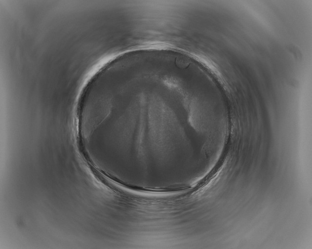 X0000113031414200908271445