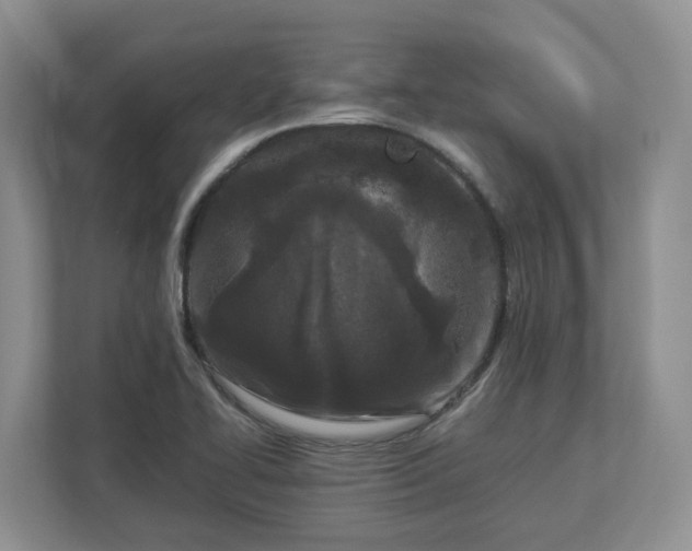 X0000113031414200909031242