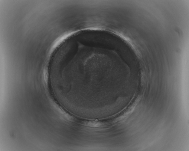 X0000113031319200909101850