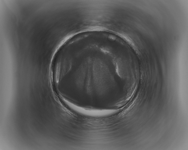 X0000113031414200909171452