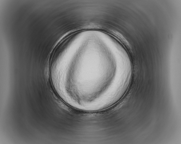 X0000113041228200909171514