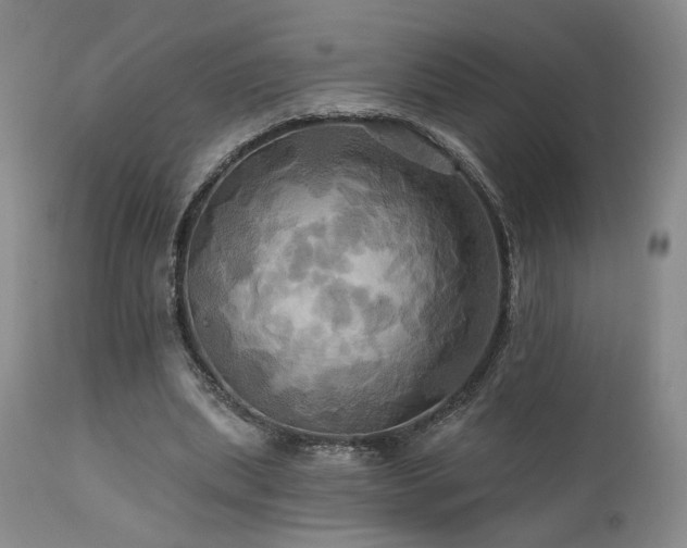 X0000113050439200908271535