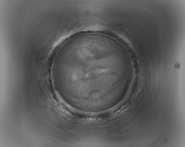 X0000113051160200908271524