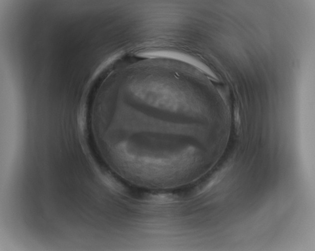 X0000113050396200909031336