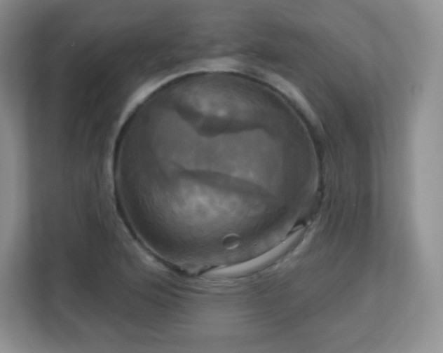 X0000113051176200909031326