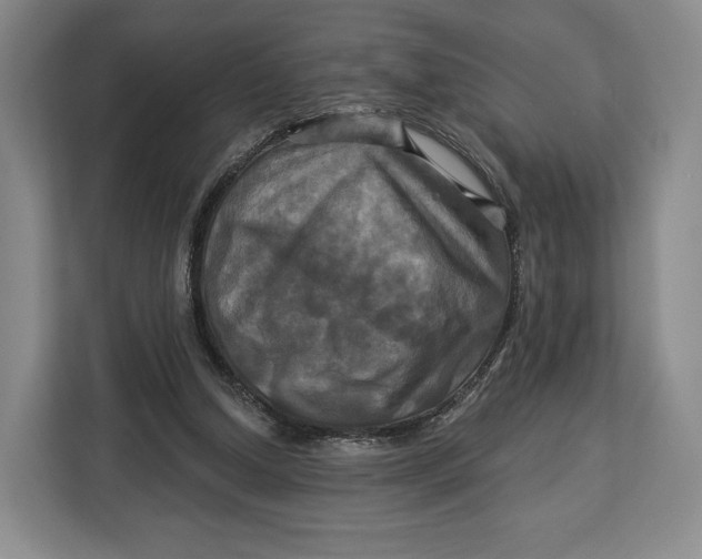 X0000113050250200909171547