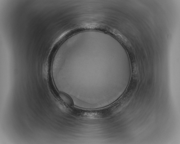 X0000113050440200909171544