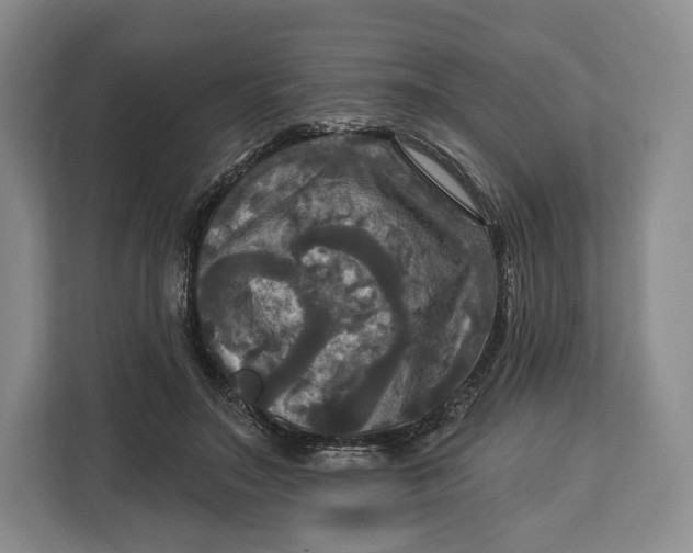 X0000113050499200909171544