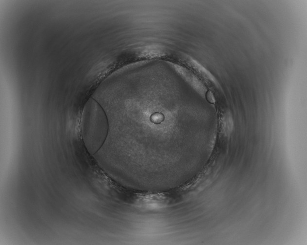 X0000113050517200909171544